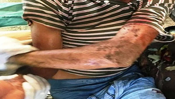 Homem invade gráfica, rende funcionário com gilete, mas acaba sendo linchado