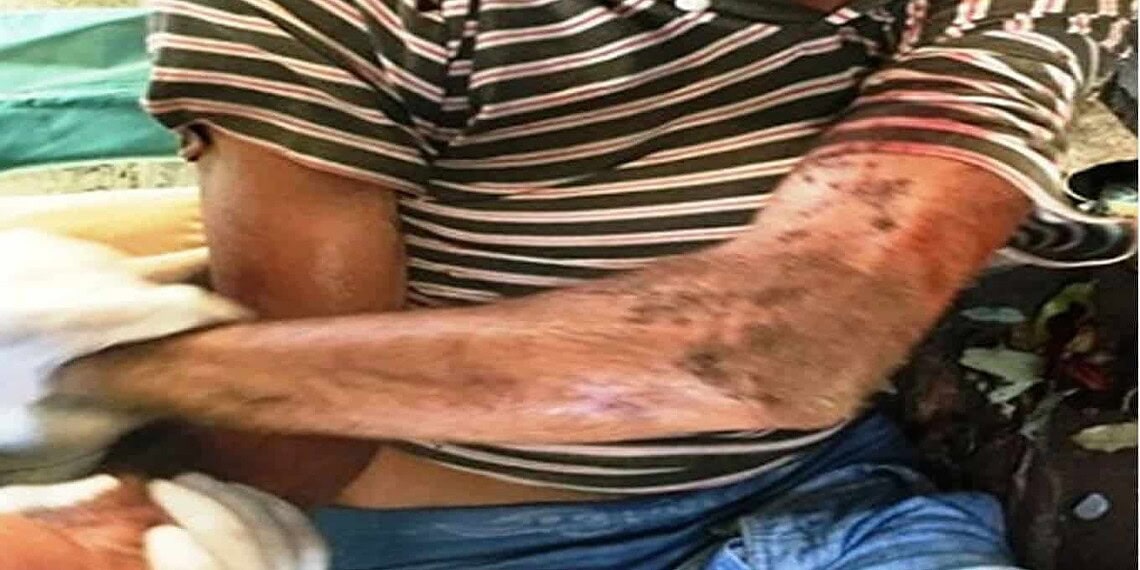 Homem invade gráfica, rende funcionário com gilete, mas acaba sendo linchado