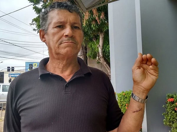 Homem reage a assalto e tem pulso cortado pelos bandidos