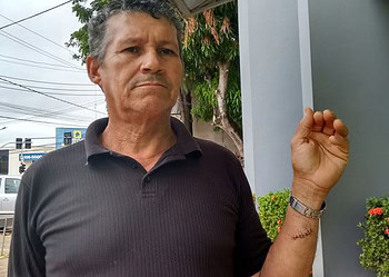 Homem reage a assalto e tem pulso cortado pelos bandidos