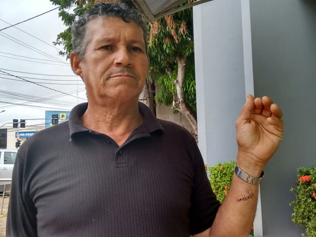 Homem reage a assalto e tem pulso cortado pelos bandidos
