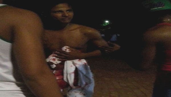 Maycon William foi esfaqueado por um estranho e depois foi levado ao PS de Rio Branco