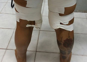 Polícia Civil prende “mula do tráfico” com drogas coladas ao corpo