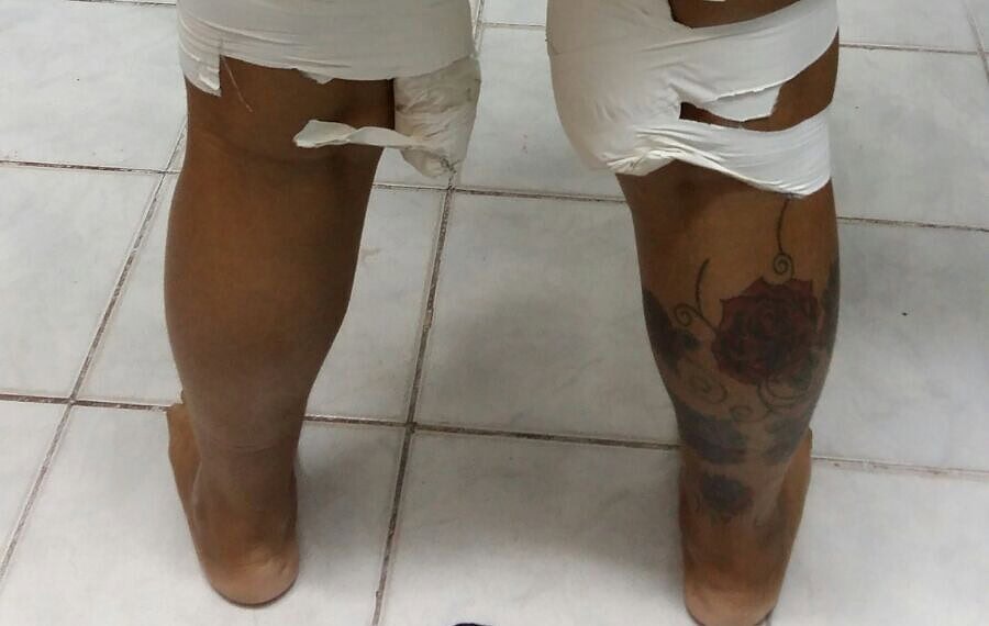 Polícia Civil prende “mula do tráfico” com drogas coladas ao corpo 1 Polícia Civil prende “mula do tráfico” com drogas coladas ao corpo