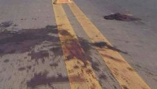 Criança de 4 anos morre no Pronto Socorro após ser atropelada por ônibus