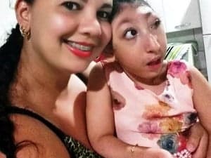 Para comprar cadeira adaptada para filha com microcefalia, mãe vende rifas