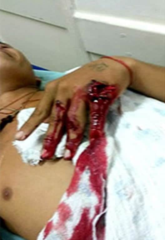 Mãe e filho são alvejados a tiro de escopeta 1