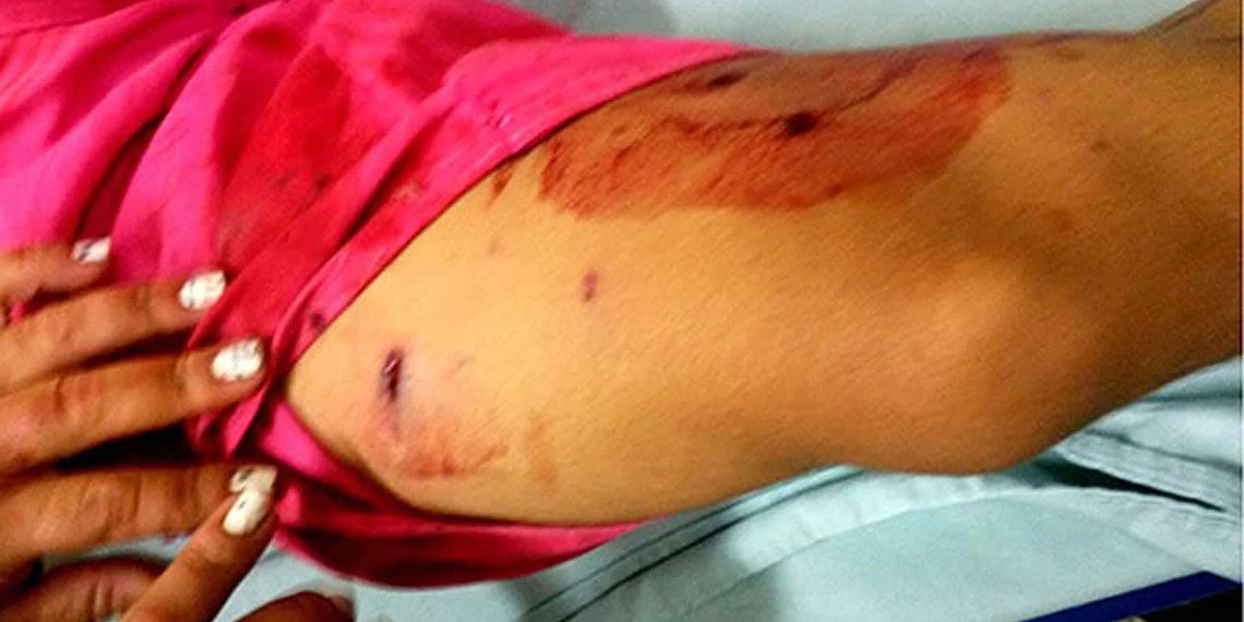 Mãe e filho são alvejados a tiros de escopeta