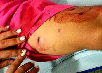 Mãe e filho são alvejados a tiros de escopeta